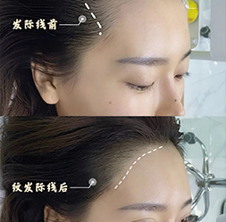 仿真发际线设计